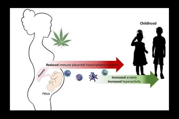 Cbd oil Side Effects During Pregnancy